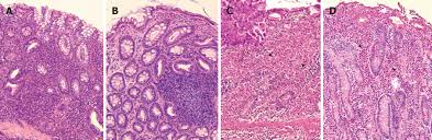 Inflammatory Bowel Disease In The Dog Differences And Similarities With Humans