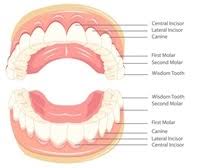 Pain how much it hurts, depends on your teeth (some peoples are more tricky to remove than others) and how good the dentist is at this specific task (some in past years, previous general dentists (who did not specialise in wisdom tooth removal) have said that if they should need removing it would be. What Are Wisdom Teeth