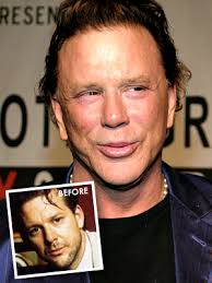 Youn, priscilla presley revealed that she . Bad Plastic Surgery On Celebrities Priscilla Presley Michael Jackson Jocelyn Wildenstein And Others Page 6 Sheknows