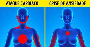 Um enfarte agudo do miocárdio (português europeu) ou infarto agudo do miocárdio (português brasileiro), vulgarmente denominado ataque cardíaco, ocorre quando a circulação de sangue para uma parte do coração é interrompida, causando lesões no músculo cardíaco.o sintoma mais comum é dor no peito ou desconforto que se pode espalhar para o ombro, costas, pescoço ou maxilar. Sera Um Enfarte Ou Um Ataque Ansiedade Viva Fisio