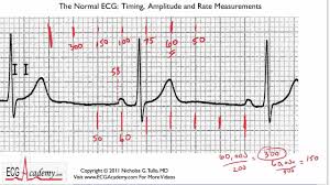 Easy Explanation Of Calculating Rate On Ecg Ekg
