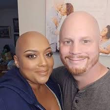 My wife went out with me for the first time without a wig. She was  diagnosed with scaring alopecia years before I met her. I remember the  first time she showed me