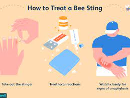 If so i would be concerned. Bee Sting What Treatments And Remedies Actually Work
