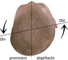Baby Kopfform Darauf Sollten Sie Bei Ihrem Baby Achten