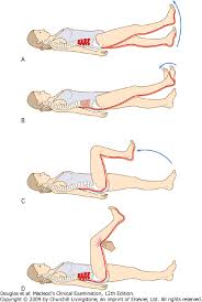 Diagnosis of root compression is probable, when on physical examination, paresis, sensory loss, reflex changes which are the neurological signs. Back Neck Pain Notes On Medicine Surgery
