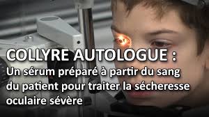 Collyre Autologue Un Serum Prepare A Partir Du Sang Du Patient Pour Traiter La Secheresse Oculaire Youtube