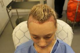 We did not find results for: Haartransplantation Forum Frauen Shefalitayal