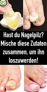 Hast Du Nagelpilz Mische Diese Zutaten Zusammen Um Ihn Loszuwerden Nail Fungus Nail Fungus Cure Discover Beauty