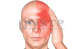 Keadaan ini boleh terjadi di seluruh bahagian kepala, atau di bahagian tertentu sahaja. Gangguan Sinus Serius