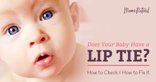 Lip Tie How To Check Your Baby And How To Fix It Tongue Tie Lips Breastfeeding
