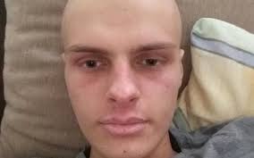 Zrzutka na Pomoc dla Pawła.