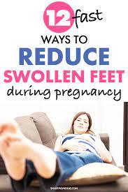 12 Best Ways To Reduce Swollen Feet During Pregnancy | Smart Mom Ideas