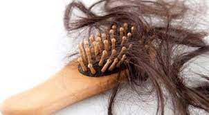 علاج تساقط الشعر الشديد عند النساء والرجال وطرق الوقاية In 2020 Fall Hair Hair Control Hair Clinic