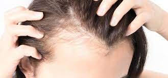 When deciding on hair extensions, it is important to find out how much weight, stress and tension will be placed on your natural hair. Hair Extensions For Thin Hair My Hair Extensions