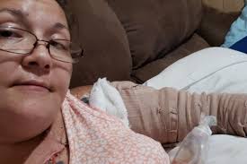 Paprasčiausio voro įkandimas moters gyvenimą pavertė pragaru