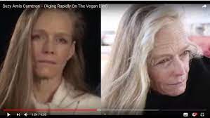 Talentovanú detskú lekárku (30) zabila anorexia: Dr Shawn Baker On Twitter From 48 To 56 Pretty Damn Impressive Aging From Vegan Filmmaker James Cameron S Wife Suzy Amis Wow Vegan Deterioration Is Real Https T Co 31ucbelflm