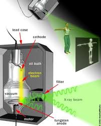How X Rays Work With Images Nuclear Medicine Diagnostic Imaging X Ray