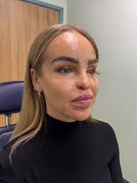 How one prosthetic eye changed his life 👁️🌟 #storytime #powerfulstory  #prosthetic #fyp