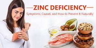Image result for Zinc Deficiency