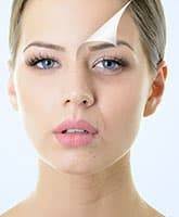 Laser Mole & Skin Tag Removal Singapore