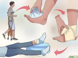 Jenis sendi yang dapat bergerak secara bergeser, satu bagian tulang bergeser di atas tulang yang lain. Biaya Pengobatan Cedera Engkel Sprain Ankle Mahal Untold Story