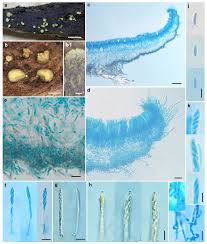 Image result for Chlorosplenium chlora