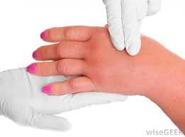 What Causes Swollen Hands With Pictures