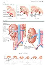 Renal Rotation And Malrotation Normal Renal Rotation During Their Normal Process Of Ascent See Plate 2 5 The Kidneys Undergo 9 Renal Body Map Abdominal