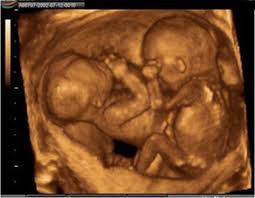 gebelikte fiziksel ve fizyolojik degisimler hafta hafta bebek gelisimi op dr cuneyt ozcan