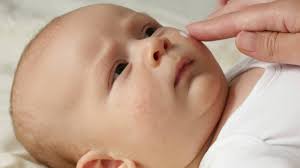 You should expect your baby to experience some redness and irritation every once in a while. Rashes In Kids An Age By Age Guide To Children S Skin Conditions