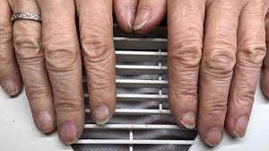 Das Bedeuten Quer Und Langsrillen In Fingernageln Wirklich Gesundheit