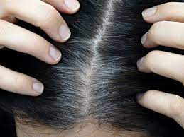 Rambut beruban prematur atau di usia muda adalah salah satu masalah umum saat ini, yang banyak dihadapi oleh pria maupun wanita setiap harinya. Punca Cara Atasi Rambut Beruban Di Usia Muda Pesona Pengantin