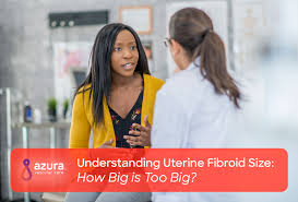 Understanding Uterine Fibroid Size How Big Is Too Big