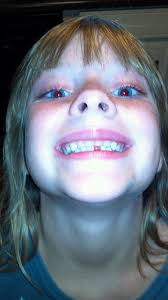 Lilly pulled her own tooth2013-07-10_18-37-48_999