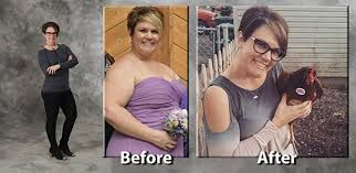 Bmi Surgery At Silver Cross Hospital Helps Ottawa Mom Improve Health After Bariatric Surgery The Herald News