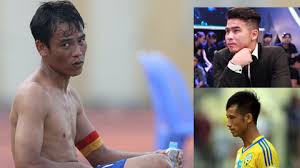 Bên cạnh trần đình trọng và nguyễn trọng hoàng bị treo giò, nguyễn văn hoàng, lý công hoàng anh, nguyễn thanh bình và nguyễn hai long không được đăng ký thi đấu ở vòng loại world cup tối 7/6. Chuyá»‡n Cac Cáº§u Thá»§ Sau Khi Giáº£i Nghá»‡ Vá» Ä'au Nhá»¯ng Idol Bong Ä'a