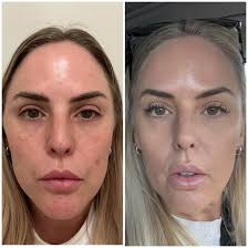 Joanne Astone (@joannemareebeautyspecialist) • Instagram photos and videos