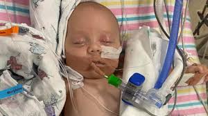 Hospital admissions for Respiratory Syncytial Virus spikes in children