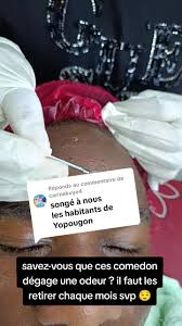 Qualité des soins au CGK de Saint Marc