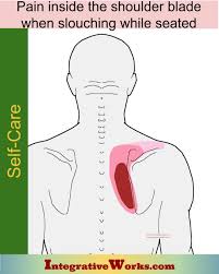 Pin On Shoulder Trigger Point Pain