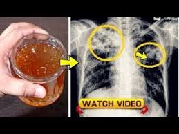 Maybe you would like to learn more about one of these? How To Clean Lungs From Smoking Alvin Blog S