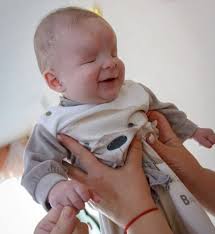 Se busca un hogar para el bebé que abandonaron por nacer sin ojos