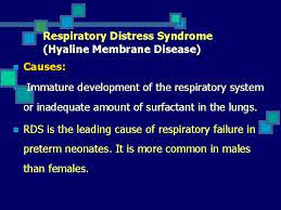 Respiratory Distress Syndrome Hyaline Membrane Disease Islamic University