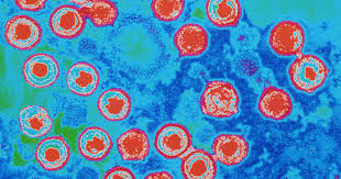 Durch schmierinfektion (küssen oder geschlechtsverkehr) überträgt sich das virus. Herpes Genitalis So Lasst Es Sich Erkennen Und Behandeln Focus Arztsuche