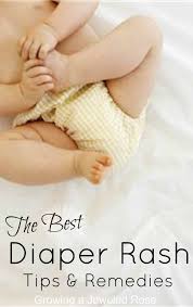 Image result for newborn diaper rash