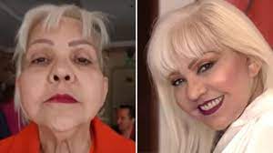 Así quedó la Gorda Fabiola tras someterse a cirugía facial: “Veo lo que  quería ver” - NoticiasCaracol