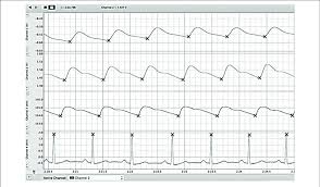Example Reading Of Labchart File We Simultaneously Recorded