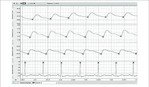 Example Reading Of Labchart File We Simultaneously Recorded