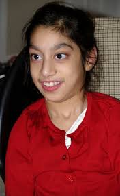 Do schizencephaly kids can live normal and healthy life . .