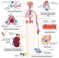 Image result for Aprocitentan